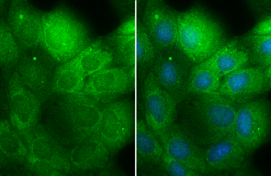 Anti-MEK1 + MEK2 antibody used in Immunocytochemistry/ Immunofluorescence (ICC/IF). GTX121942