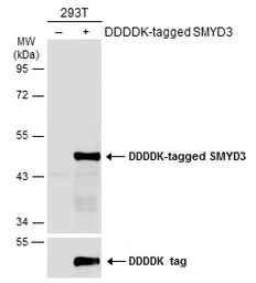 Anti-SMYD3 antibody used in Western Blot (WB). GTX121945