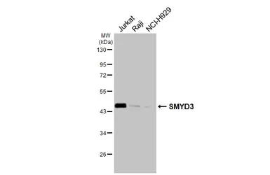 Anti-SMYD3 antibody used in Western Blot (WB). GTX121945