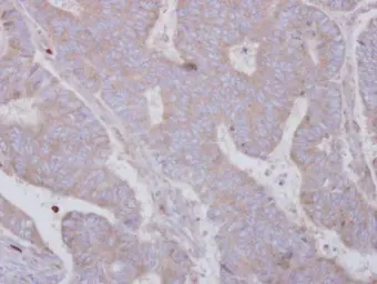 Anti-SMYD3 antibody used in IHC (Paraffin sections) (IHC-P). GTX121956