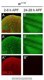 Anti-Histone H3 antibody used in Immunohistochemistry (IHC). GTX122148