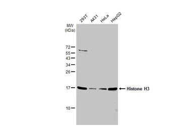 Anti-Histone H3 antibody used in Western Blot (WB). GTX122148
