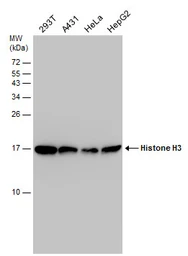 Anti-Histone H3 antibody used in Western Blot (WB). GTX122150