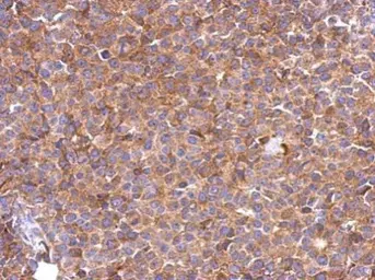 Anti-SLC25A46 antibody [N2C2], Internal used in IHC (Paraffin sections) (IHC-P). GTX122233