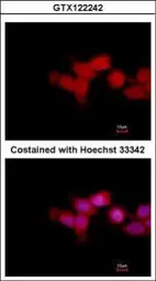 Anti-OTUD6B antibody used in Immunocytochemistry/ Immunofluorescence (ICC/IF). GTX122242