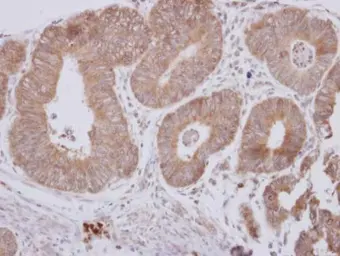 Anti-CPEB1 antibody used in IHC (Paraffin sections) (IHC-P). GTX122410
