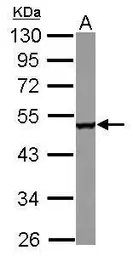 Anti-CPEB1 antibody used in Western Blot (WB). GTX122410