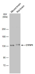 Anti-CYFIP1 antibody [N1N2], N-term used in Western Blot (WB). GTX122467