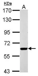Anti-RUNDC1 antibody used in Western Blot (WB). GTX122487
