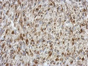 Anti-SDF4 antibody used in IHC (Paraffin sections) (IHC-P). GTX122508