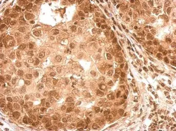 Anti-ROCK2 (phospho Ser1366) antibody used in IHC (Paraffin sections) (IHC-P). GTX122651