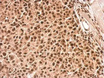 Anti-ROCK2 (phospho Ser1366) antibody used in IHC (Paraffin sections) (IHC-P). GTX122651