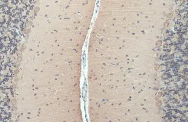 Anti-ROCK2 (phospho Ser1366) antibody used in IHC (Paraffin sections) (IHC-P). GTX122651