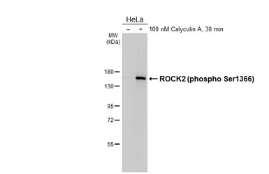 Anti-ROCK2 (phospho Ser1366) antibody used in Western Blot (WB). GTX122651