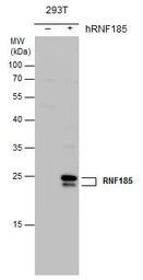 Anti-RNF185 antibody [N1C3] used in Western Blot (WB). GTX122691
