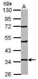 Anti-PAQR6 antibody used in Western Blot (WB). GTX122692