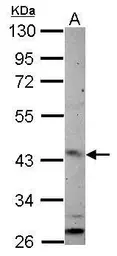 Anti-ARL13B antibody used in Western Blot (WB). GTX122703