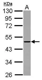 Anti-THUMPD2 antibody used in Western Blot (WB). GTX122789