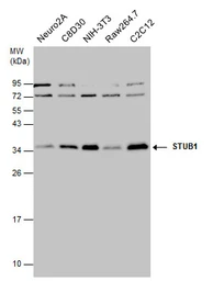Anti-STUB1 antibody [N1C3] used in Western Blot (WB). GTX122827
