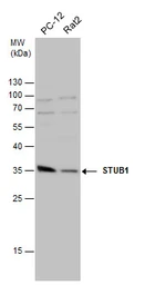 Anti-STUB1 antibody [N1C3] used in Western Blot (WB). GTX122827