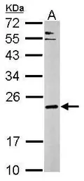 Anti-Complexin 3 antibody used in Western Blot (WB). GTX122908