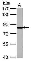 Anti-SUPV3L1 antibody [C2C3], C-term used in Western Blot (WB). GTX123034