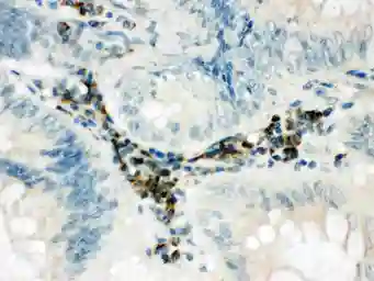 Anti-SPARCL1 antibody used in IHC (Paraffin sections) (IHC-P). GTX12308