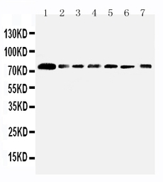 Anti-SPARCL1 antibody used in Western Blot (WB). GTX12308