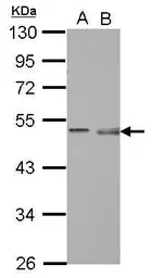 Anti-Pellino1 antibody [N1C1] used in Western Blot (WB). GTX123102