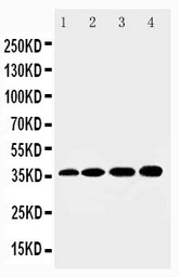 Anti-HSD17B1 antibody used in Western Blot (WB). GTX12312