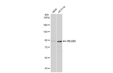 Anti-PLCD3 antibody used in Western Blot (WB). GTX123172