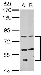 Anti-CCDC114 antibody used in Western Blot (WB). GTX123287