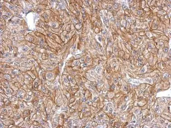 Anti-FLRT2 antibody used in IHC (Paraffin sections) (IHC-P). GTX123309