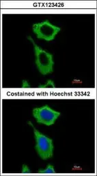 Anti-ALDH1A1 antibody used in Immunocytochemistry/ Immunofluorescence (ICC/IF). GTX123426