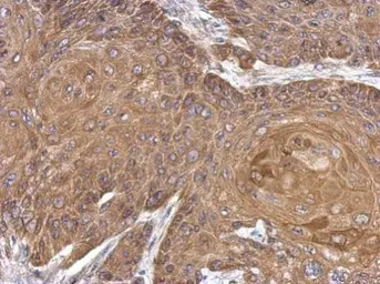 Anti-ALDH1A1 antibody used in IHC (Paraffin sections) (IHC-P). GTX123426