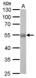 Anti-ALDH1A1 antibody used in Western Blot (WB). GTX123426