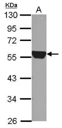 Anti-ALDH1A1 antibody used in Western Blot (WB). GTX123426