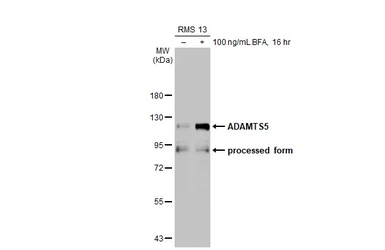 Anti-ADAMTS5 antibody [N3C2], Internal used in Western Blot (WB). GTX123657