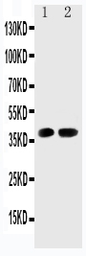 Anti-CDK6 antibody used in Western Blot (WB). GTX12366