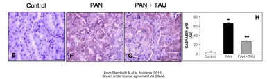 Anti-Caspase 1 p10 subunit antibody used in IHC (Paraffin sections) (IHC-P). GTX123675