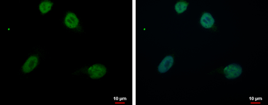 Anti-RED antibody used in Immunocytochemistry/ Immunofluorescence (ICC/IF). GTX123717