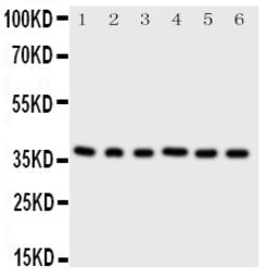 Anti-CDK7 antibody used in Western Blot (WB). GTX12373