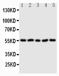 Anti-Syndecan 3 antibody used in Western Blot (WB). GTX12378
