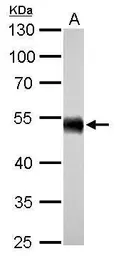 Anti-ALDH1A1 antibody used in Western Blot (WB). GTX123973
