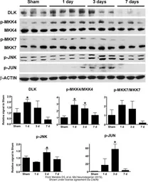 Anti-DLK/MAP3K12 antibody used in Western Blot (WB). GTX124127