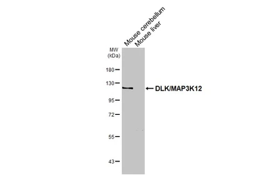 Anti-DLK/MAP3K12 antibody used in Western Blot (WB). GTX124127