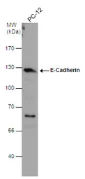 Anti-E-Cadherin antibody [N3C2], Internal used in Western Blot (WB). GTX124178
