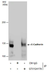 Anti-E-Cadherin antibody [N3C2], Internal used in Immunoprecipitation (IP). GTX124178