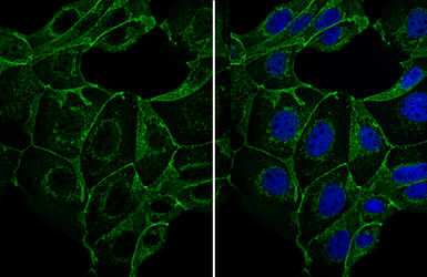 Anti-E-Cadherin antibody [N3C2], Internal used in Immunocytochemistry/ Immunofluorescence (ICC/IF). GTX124178