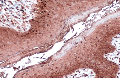 Anti-E-Cadherin antibody [N3C2], Internal used in IHC (Paraffin sections) (IHC-P). GTX124178
